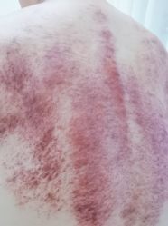 -御品•瑶浴灸疗SPA