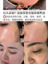 -+MS卓美丝专业祛痘·皮肤管理中心
