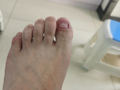 -世龙世家甲沟炎·灰指甲·嵌甲矫正·修脚(武侯区双楠店)