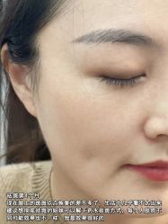 -清疣美疣·痣·斑净肤中心