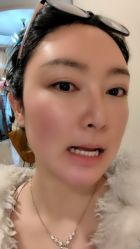 体验后-四川娇点医学美容医院