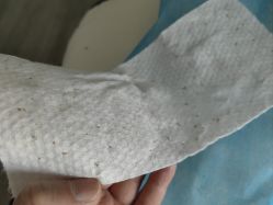 -爱莎扁平疣·汗管瘤·斑痣中心