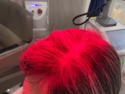 -雍禾植发全国连锁