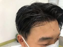 -发饰美男士增发补发假发定制店