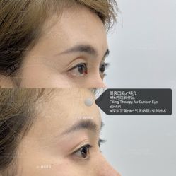 -深圳艺星医疗美容医院