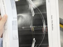 -武汉大学附属爱尔眼科医院(湖北总院)