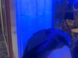 -碧莲盛·不剃发植发