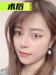 -素美医疗美容·西南眼鼻整形·修复基地