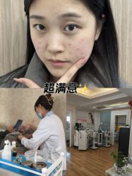 -成都苗方清颜专业祛痘