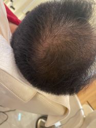 -希梵尔头皮抗衰·科技养发