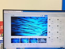 -碧莲盛·不剃发植发