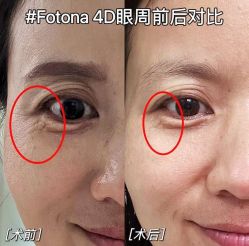 -安徽合肥韩美整形外科医院