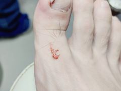 -新甲连锁灰指甲·甲沟炎·鸡眼(黑龙江路店)