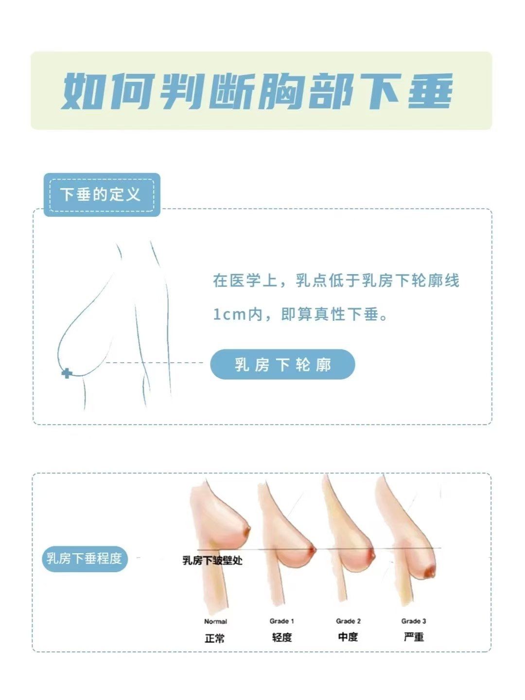 乳房那些事断奶后,胸为什么会下垂?