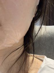 体验后-广州美莱医疗美容医院