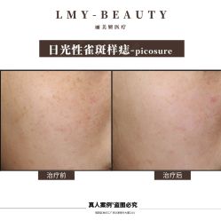 -丽美妍医疗美容·皮秒·立体分层抗衰
