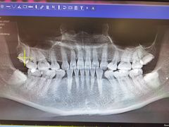 -清华大学玉泉医院