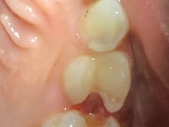 -天使口腔门诊部(上海店)