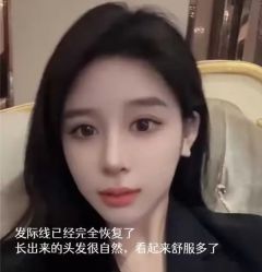 -大麦微针植发丨全国连锁