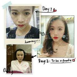 -厦门美莱整形美容医院