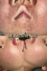 -春田皮肤管理中心品牌旗舰店