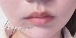 -RC半永久纹眉纹发际线