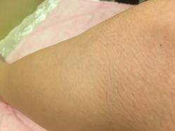 -韩莱科技美肤连锁