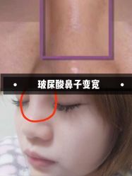 -成都大华医学美容医院