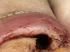 -新甲连锁灰指甲·甲沟炎·鸡眼(黑龙江路店)