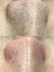 -SKIN79皮肤管理中心