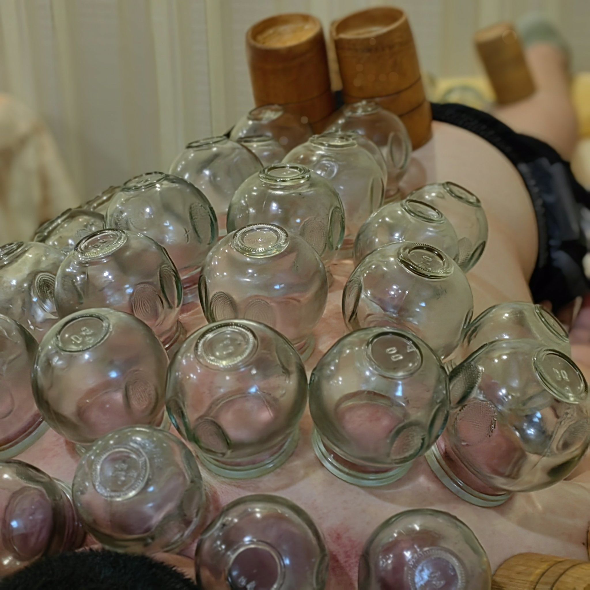 拔罐的小常识,你知道吗