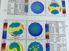 -上海大学附属上海和平眼科医院