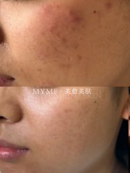 -美愈美肤MEIYU SKIN