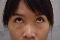 -天津健丽·去眼袋医疗美容机构