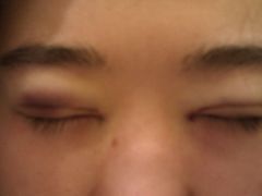 刚开好，上手术台！-上海华安整形外科门诊部