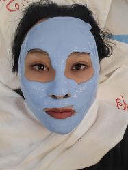 体验后-成都苗方清颜专业祛痘