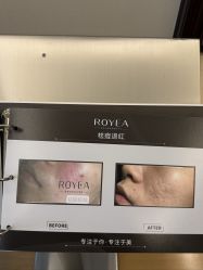 -ROYEA茹彦祛痘·问题肌肤修护中心