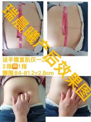 -瑞晨曦催乳产后健康(枣园店)