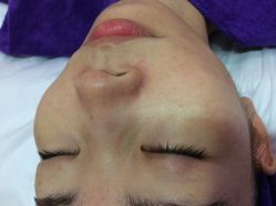 -晶奕空间专业脱毛连锁机构