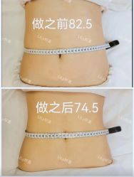 -Lily纤美·科技减脂中心