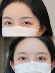 点击看大图 -Doris多里斯半永久纹眉·SMP纹发·发际线