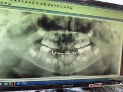 -宁波口腔医院(鄞州分院)