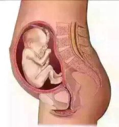 -香薇妮丝女子减肥院