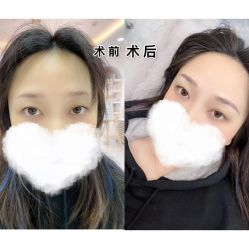 -Verywang半永久纹眉•仪器野生眉