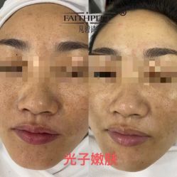 -凡碧诗毛孔收细