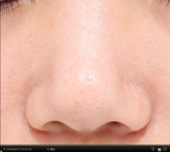 -韩国淼美颜皮肤管理官方直营店