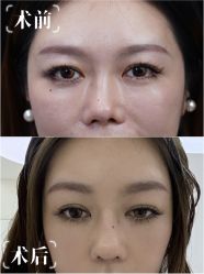 -深圳艺星医疗美容医院