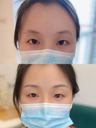 -Doris多里斯半永久纹眉·SMP纹发·发际线