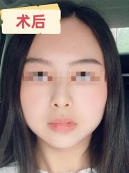 -素美医疗美容·西南眼鼻整形·修复基地