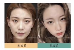 -LUNA皮相美·骨相美高级美感